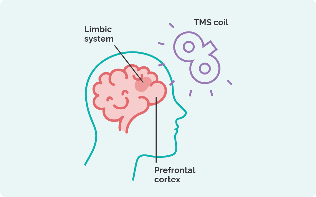 How Does TMS Work?